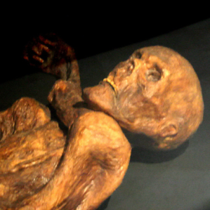 Ötzi
